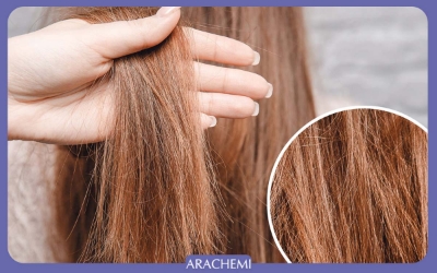 روش های آحیای موهای آسیب دیده